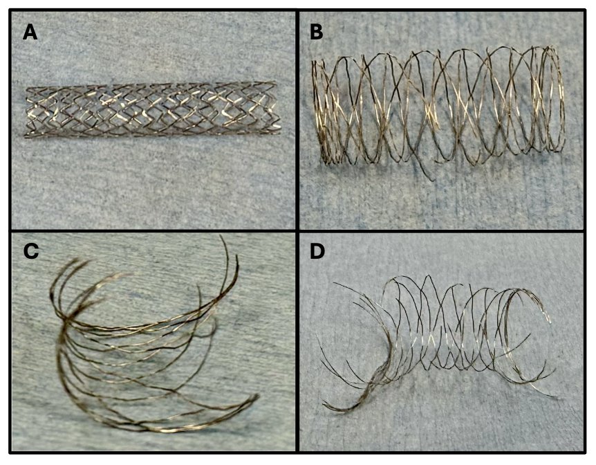 Onyx Stent Linear Fracture Pattern